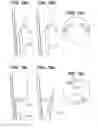 Fig. 11 - Injection device