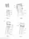 Fig. 03 - Injection device having a needle protection system