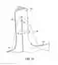 Fig. 11 - RAPID CLOSING SURGICAL CLOSURE DEVICE