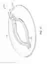 Fig. 17 - RAPID CLOSING SURGICAL CLOSURE DEVICE