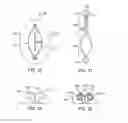 Fig. 20 - RAPID CLOSING SURGICAL CLOSURE DEVICE