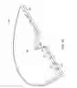 Fig. 37 - RAPID CLOSING SURGICAL CLOSURE DEVICE