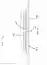 Fig. 55 - RAPID CLOSING SURGICAL CLOSURE DEVICE