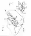 Fig. 58 - RAPID CLOSING SURGICAL CLOSURE DEVICE