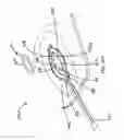 Fig. 74 - RAPID CLOSING SURGICAL CLOSURE DEVICE