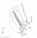 Fig. 76 - RAPID CLOSING SURGICAL CLOSURE DEVICE