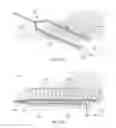 Fig. 80 - RAPID CLOSING SURGICAL CLOSURE DEVICE