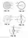 Fig. 03 - DEVICE AND METHOD FOR HINDERING FORMATION OF LIPOHYPERTROPHY