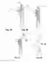 Fig. 22 - Nasal delivery device
