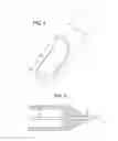 Fig. 04 - TUBE TIP BEVEL TO AID WIRE GUIDE INSERTION