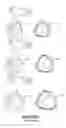 Fig. 02 - Breathing assistance apparatus