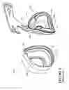 Fig. 06 - Breathing assistance apparatus