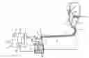 Fig. 01 - Breathing assistance apparatus