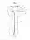 Fig. 02 - Stretch valve balloon catheter and methods for producing and using same