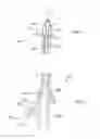 Fig. 03 - Stretch valve balloon catheter and methods for producing and using same