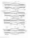 Fig. 15 - Stretch valve balloon catheter and methods for producing and using same