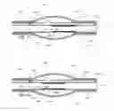 Fig. 16 - Stretch valve balloon catheter and methods for producing and using same
