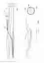 Fig. 03 - CATHETER SYSTEM