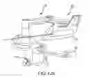 Fig. 33 - Robotic catheter system