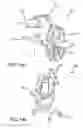 Fig. 40 - Robotic catheter system