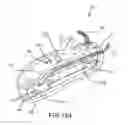 Fig. 42 - Robotic catheter system