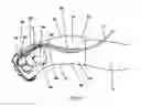Fig. 02 - An Intravenous Cannula Retainer