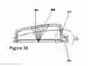 Fig. 18 - An Intravenous Cannula Retainer