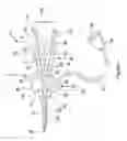Fig. 02 - Catheter assembly