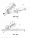 Fig. 07 - Inflation device for balloon sinus dilation