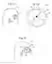 Fig. 02 - Adjustable height hydrocephalus valve location device