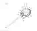 Fig. 04 - Port for a catheter