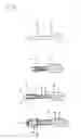 Fig. 03 - Peripheral IV catheter with Bi-valve secure system