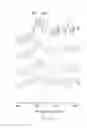 Fig. 13 - Fluoride iontophoresis device and method thereof