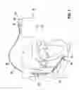 Fig. 02 - IMPLANTABLE ELECTRICAL LINE