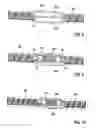 Fig. 06 - IMPLANTABLE ELECTRICAL LINE