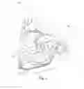Fig. 05 - Surgical guide and method for guiding a therapy delivery device into the pterygopalatine fossa