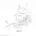 Fig. 15 - Surgical guide and method for guiding a therapy delivery device into the pterygopalatine fossa