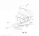Fig. 18 - Surgical guide and method for guiding a therapy delivery device into the pterygopalatine fossa