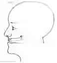 Fig. 03 - DEVICE AND METHOD FOR TREATMENT OF SLEEP APNEA