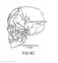 Fig. 07 - Systems, devices and methods for the treatment of neurological disorders and conditions