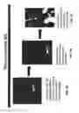 Fig. 53 - Methods and apparatuses for remodeling tissue of or adjacent to a body passage