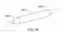 Fig. 56 - Methods and apparatuses for remodeling tissue of or adjacent to a body passage