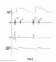 Fig. 02 - Pulse detection apparatus, software, and methods using patient physiological signals
