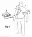 Fig. 03 - Pulse detection apparatus, software, and methods using patient physiological signals