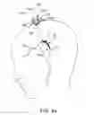 Fig. 05 - Ischemic Stroke Therapy