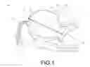 Fig. 02 - Helmet for anesthesia