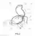Fig. 03 - Helmet for anesthesia