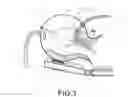 Fig. 04 - Helmet for anesthesia