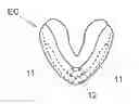 Fig. 01 - Exercise cushion