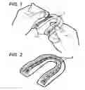 Fig. 02 - Mouth Protector Adhesion Method